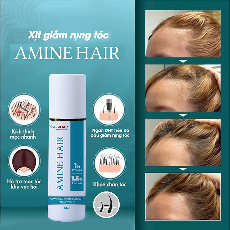 Thuốc xịt mọc tóc Amine Hair - Aminexil 1.5% (Nam và Nữ) - Ảnh 4